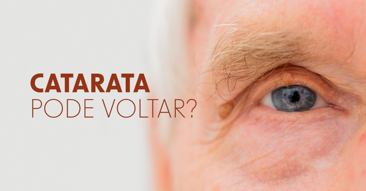 A catarata pode voltar? Entenda a verdade sobre a recidiva após a cirurgia