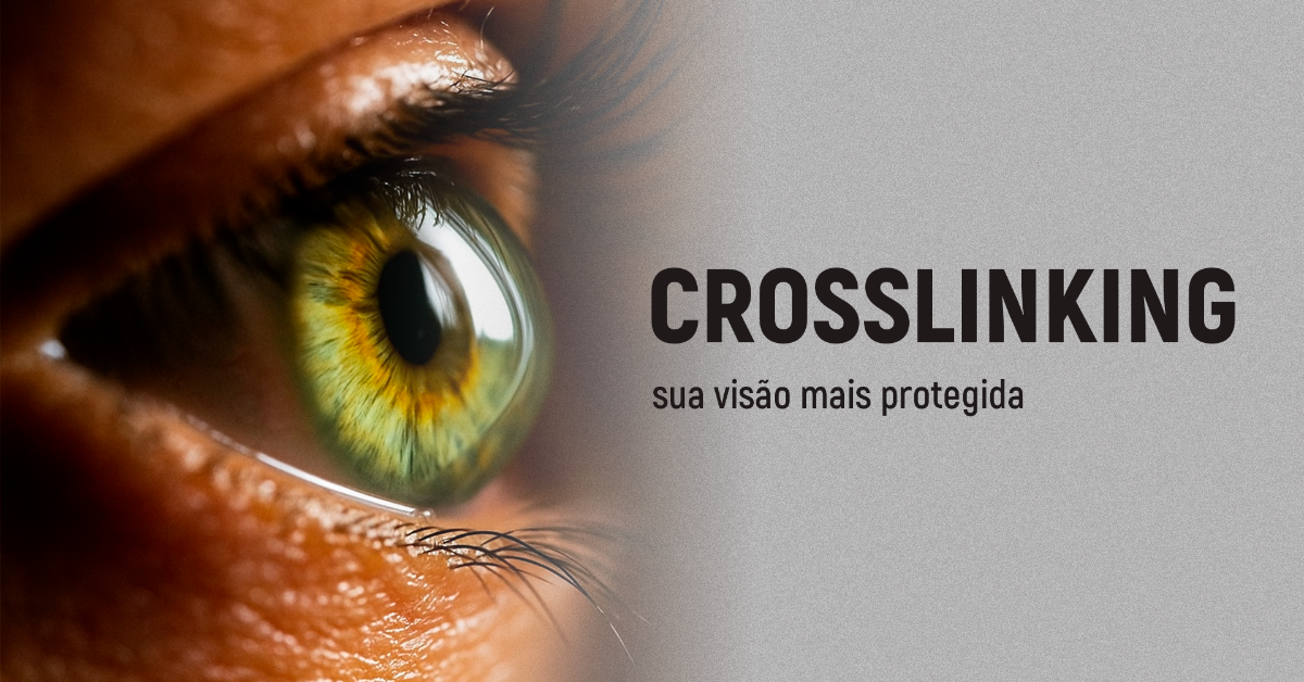 Como funciona o crosslinking para tratar o ceratocone?