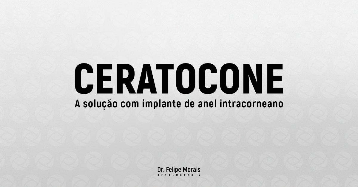 Implante de Anel Intracorneano: Tratamento Inovador para Ceratocone