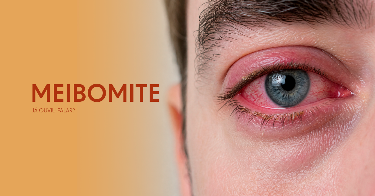 Meibomite: a inflamação que merece sua atenção
