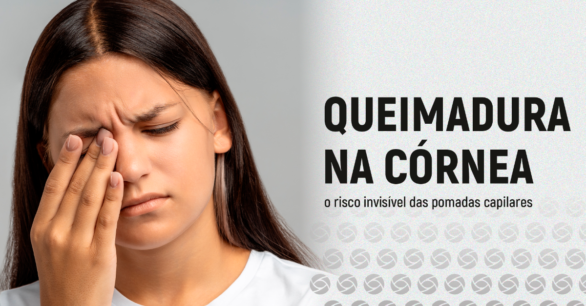 Queimaduras na Córnea por Produtos Capilares: Um Risco Real para os Olhos