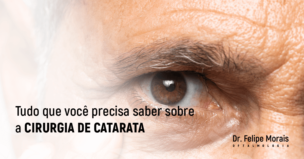 Tudo que você precisa saber sobre a cirurgia de catarata